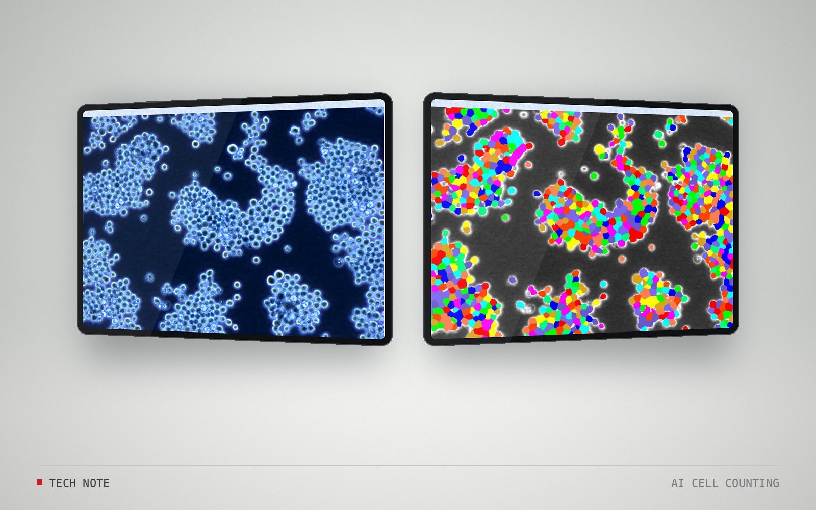 Tech note: AI cell counting — a usable model from a single original image